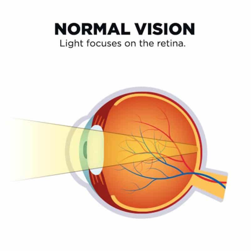 normal vision